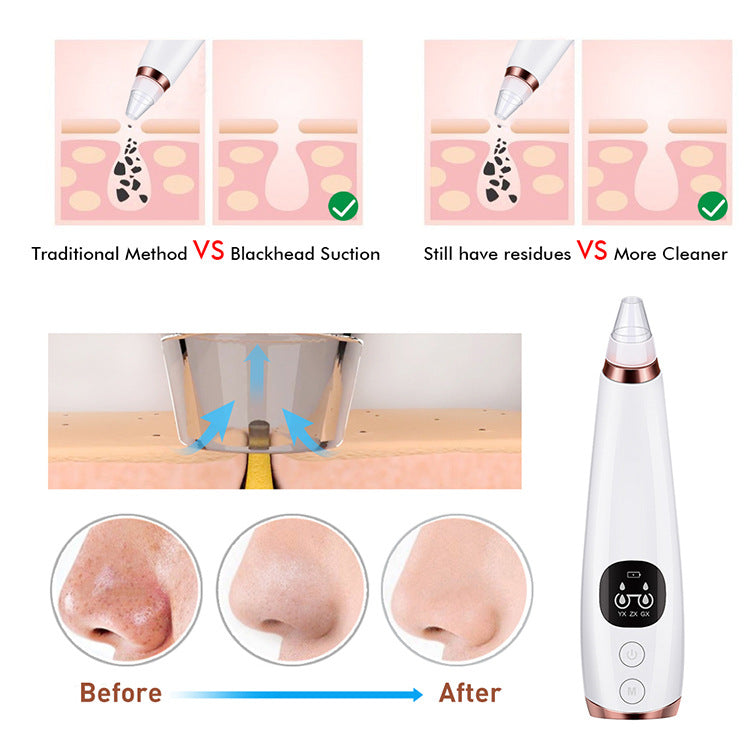 Advanced Facial Pore Vacuum - Professional Blackhead Removal System